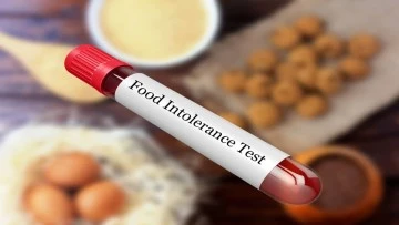 Gıda İntoleransı Testi ile Bağırsak Sorunlarına Son